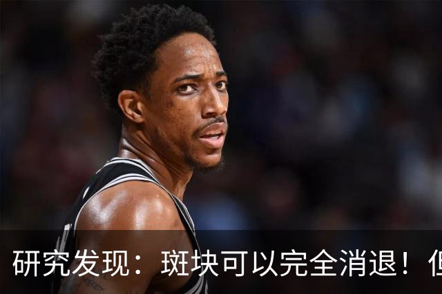 研究发现：斑块可以完全消退！但需要满足4个条件